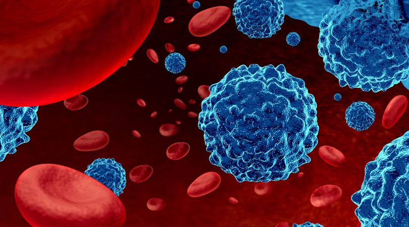 Hematological Blood Cancer treatement in Mumbai by Dr Rohit Pai, best oncologist in Mumbai