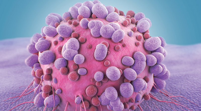 Rare and specialized Oncology Cases treatment in Mumbai by Dr Rohit Pai, best oncologist in Mumbai