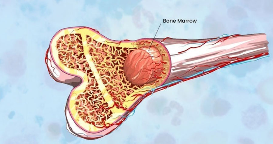 Bone Marrow Transplantation